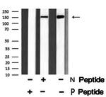 Phospho-ALK (Tyr1586) Polyclonal Antibody