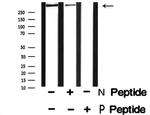 Phospho-IP3 Receptor 1 (Tyr353) Antibody in Western Blot (WB)