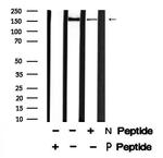 Phospho-LRP6 (Thr1479) Polyclonal Antibody