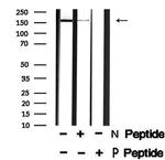Phospho-LRP6 (Ser1490) Polyclonal Antibody