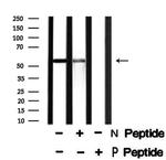 Phospho-DOK2 (Tyr345) Antibody in Western Blot (WB)