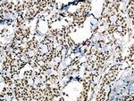 Phospho-POLR2A (Ser1616) Antibody in Immunohistochemistry (Paraffin) (IHC (P))