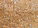 Phospho-Cardiac Troponin I (Ser23, Ser24) Antibody in Immunohistochemistry (Paraffin) (IHC (P))