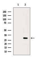 Phospho-Cardiac Troponin I (Ser23, Ser24) Antibody in Western Blot (WB)