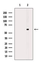 Phospho-AKT1 (Ser473, Tyr474) Antibody in Western Blot (WB)