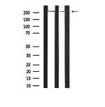 Phospho-CaV1.2 (Ser1981) Antibody in Western Blot (WB)