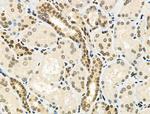 Phospho-E2F1 (Ser364) Polyclonal Antibody