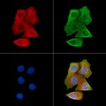 Phospho-GABBR2 (Ser884) Polyclonal Antibody