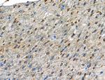 Phospho-GABBR2 (Ser893) Polyclonal Antibody
