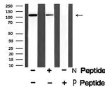 Phospho-GABBR2 (Ser893) Antibody in Western Blot (WB)
