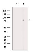 Phospho-GRK2 (Tyr86) Antibody in Western Blot (WB)