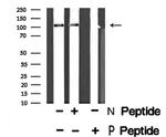 Phospho-HDAC7 (Ser486) Antibody in Western Blot (WB)