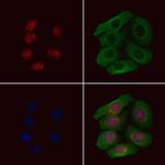 Phospho-IRF5 (Ser437) Polyclonal Antibody