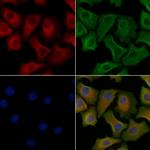 Phospho-IRS2 (Ser1100) Polyclonal Antibody