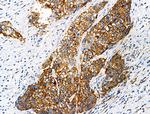 Phospho-ITGB1 (Tyr783) Antibody in Immunohistochemistry (Paraffin) (IHC (P))