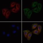 Phospho-ITGB1 (Tyr783) Antibody in Immunocytochemistry (ICC/IF)