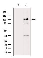 Phospho-Mdm2 (Tyr394) Polyclonal Antibody