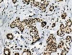 Phospho-PRC1 (Thr470) Antibody in Immunohistochemistry (Paraffin) (IHC (P))