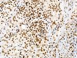Phospho-PRC1 (Thr470) Polyclonal Antibody