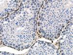 Phospho-PRC1 (Thr470) Antibody in Immunohistochemistry (Paraffin) (IHC (P))