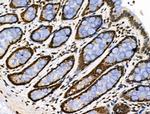 Phospho-PRC1 (Thr470) Antibody in Immunohistochemistry (Paraffin) (IHC (P))