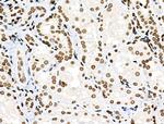 Phospho-PRC1 (Thr481) Antibody in Immunohistochemistry (Paraffin) (IHC (P))
