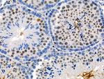 Phospho-PKC alpha (Thr497) Antibody in Immunohistochemistry (Paraffin) (IHC (P))