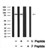 Phospho-PKC alpha (Thr497) Antibody in Western Blot (WB)
