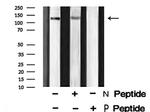 Phospho-p130 (Ser639) Antibody in Western Blot (WB)