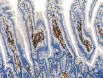 Phospho-ROCK2 (Tyr722) Polyclonal Antibody