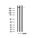 Phospho-ATM (Ser1987) Antibody in Western Blot (WB)