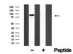 Axl Polyclonal Antibody
