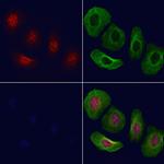 Phospho-Chk2 (Ser379) Antibody in Immunocytochemistry (ICC/IF)