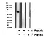 Phospho-Chk2 (Ser379) Antibody in Western Blot (WB)