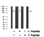 Phospho-CSF1R (Tyr921) Antibody in Western Blot (WB)