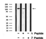 Phospho-EphA1 (Tyr781) Polyclonal Antibody