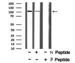 Phospho-EphA3 (Tyr602) Antibody in Western Blot (WB)