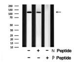Phospho-EphA5 (Tyr650) Antibody in Western Blot (WB)