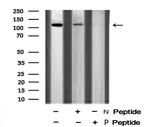Phospho-EphB3 (Tyr608) Antibody in Western Blot (WB)