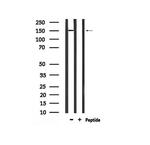 Phospho-ErbB4 (Tyr1242) Antibody in Western Blot (WB)
