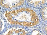 Phospho-Met (Tyr1313) Antibody in Immunohistochemistry (Paraffin) (IHC (P))