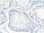 Phospho-Met (Tyr1313) Antibody in Immunohistochemistry (Paraffin) (IHC (P))