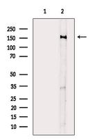 Phospho-Met (Tyr1313) Antibody in Western Blot (WB)