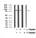 Phospho-Mre11 (Ser676) Polyclonal Antibody