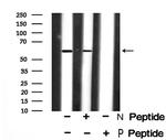 Phospho-SMAD3 (Ser423) Antibody in Western Blot (WB)