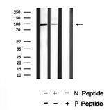 Phospho-SRPK1 (Thr601) Polyclonal Antibody