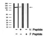 Phospho-ATP1A1 (Tyr260) Antibody in Western Blot (WB)