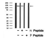 Phospho-SMC3 (Ser1067) Antibody in Western Blot (WB)