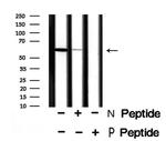 Phospho-TPL2 (Ser400) Polyclonal Antibody