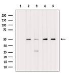 Phospho-eIF5 (Ser389, Ser390) Antibody in Western Blot (WB)